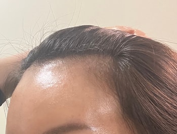 수술전