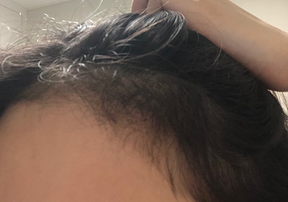 어제 찍은 4개월 셀카 