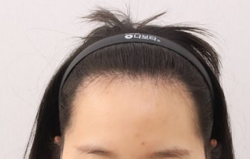 전333