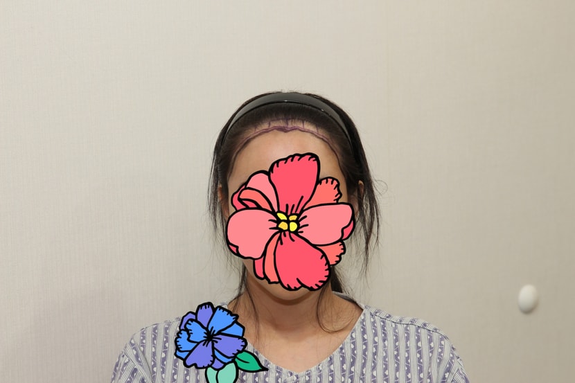앞