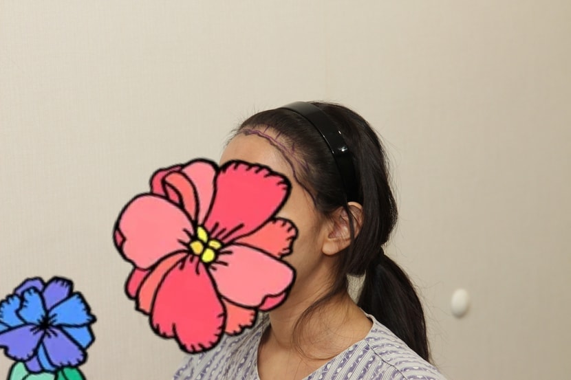 옆