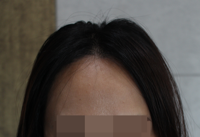 지금 머리 내린모습