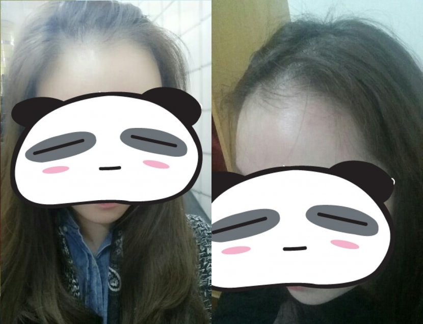 수술 전 사진입니다.