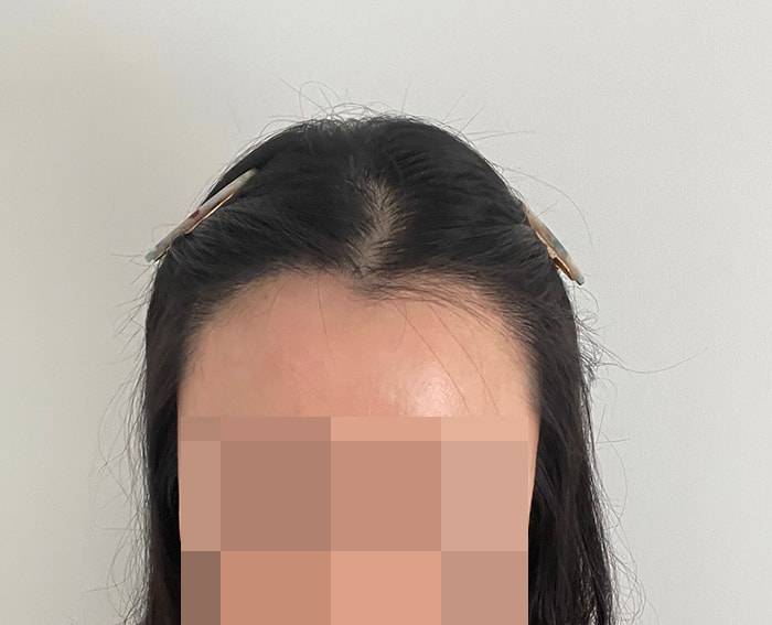 최근에 집에서 혼자 찍어봤어요~ 앞에 더듬이는 제모할까 고민중입니다 ㅠ
