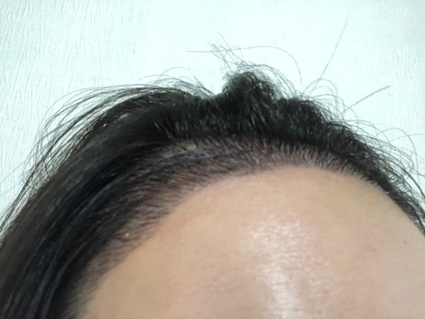 후