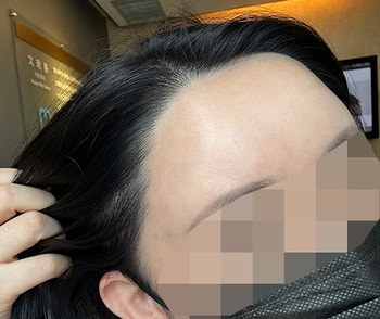 3년5개월 셀카-이번에 병원 로비에 앉아서 찍은 사진이에요