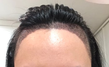 2주차 상태입니다