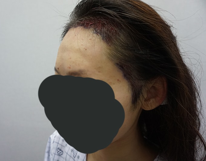 수술당일 