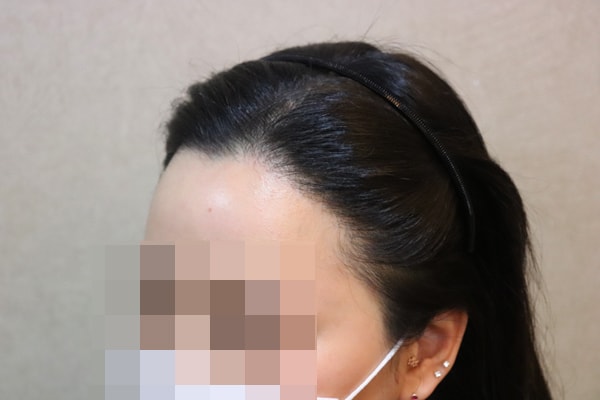 후