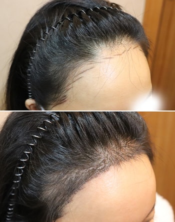 마찬가지로 위에서 본 오른쪽