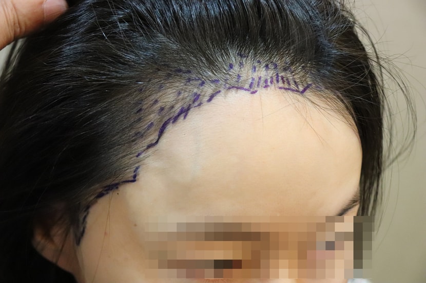 반대편 디자인 사진 