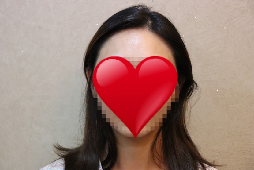 후