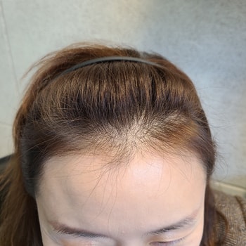 현재1