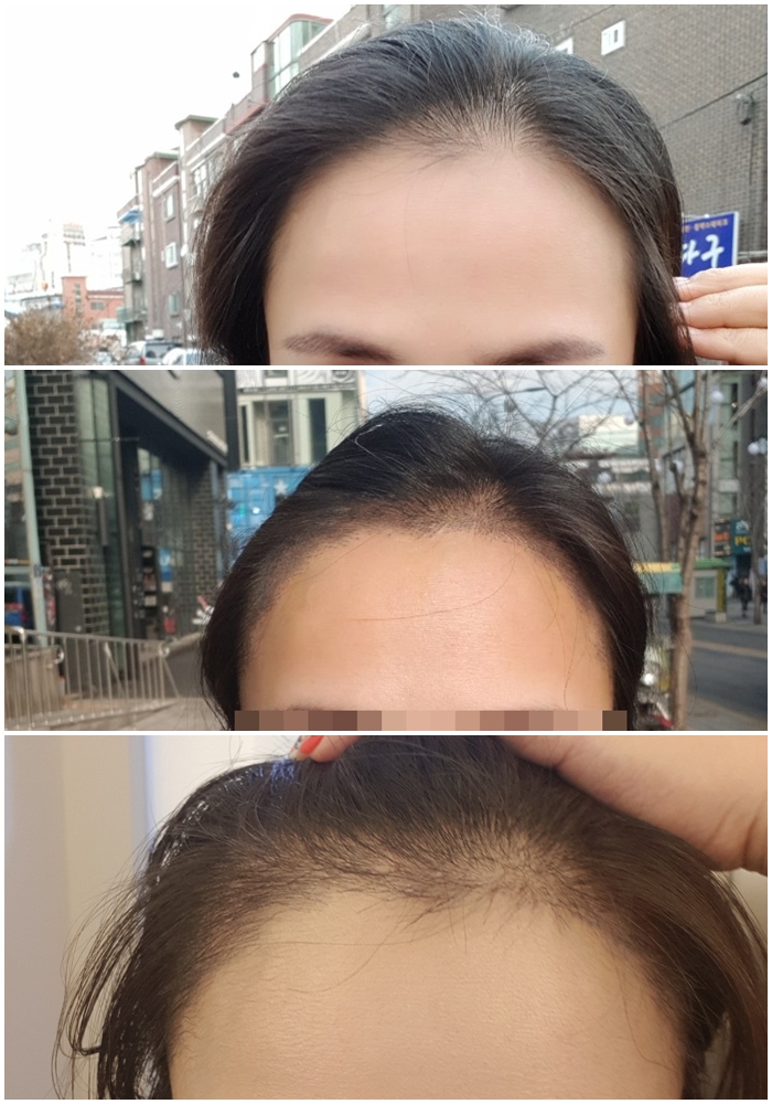 2개월차 1.jpg
