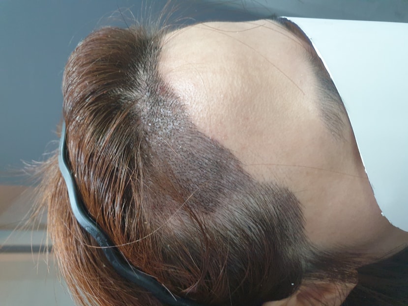 왼쪽에서 찍은 사진