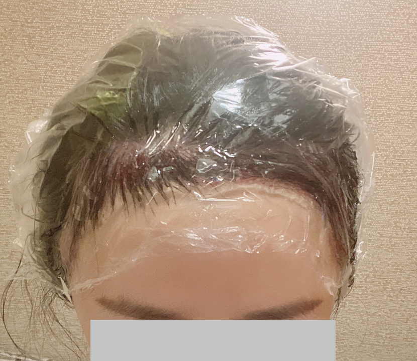 수술당일