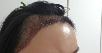 3일차 우측