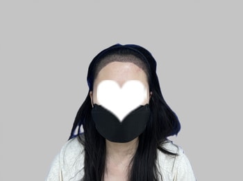 이식 2주차 사진이에요 아직 암흑기 전....