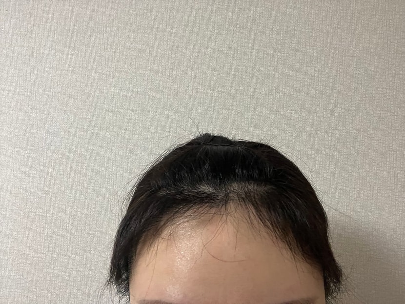 7개월차