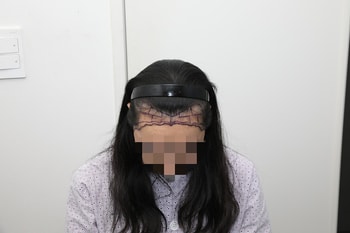수술 전