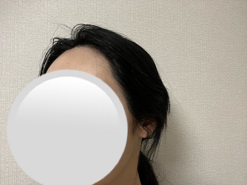 1년차