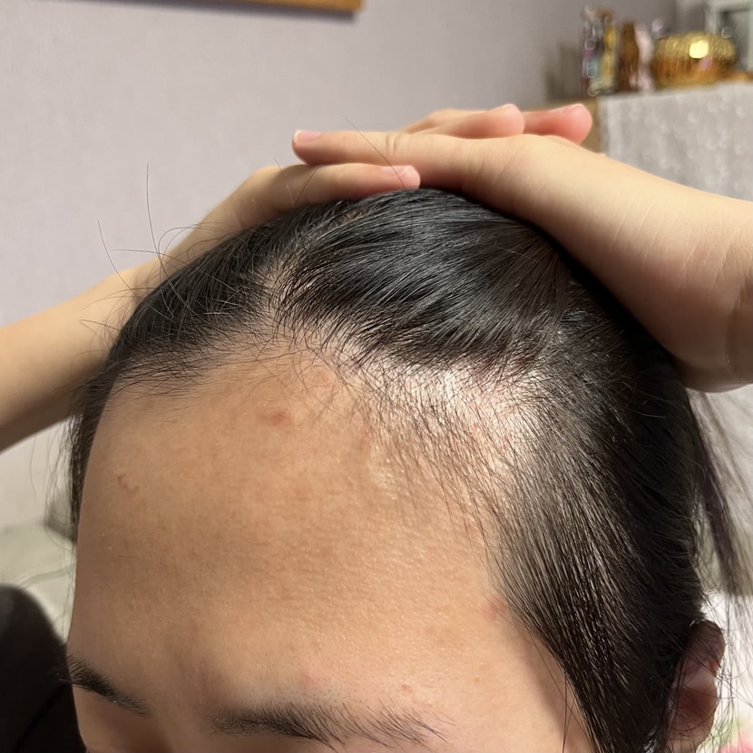 수술 전