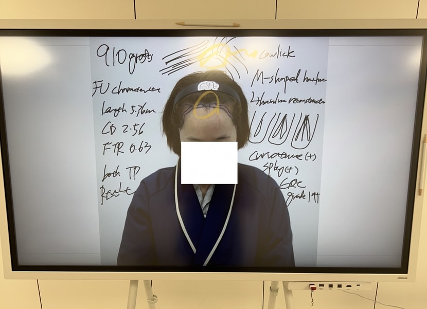 수술 완료 후 브리핑 사진