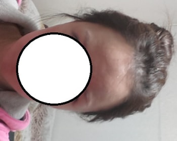 9개월째 최근 사진이에요 ㅎ