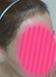 잔머리처럼 자라더라구요 ㅎ 