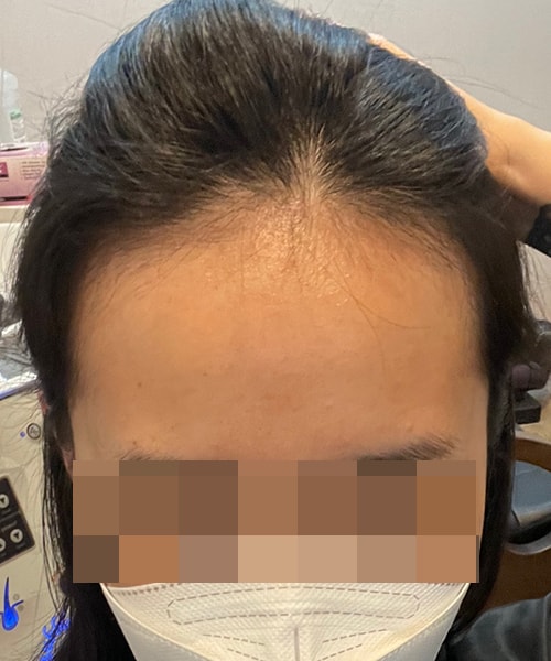 어제 케어받고 폰셀