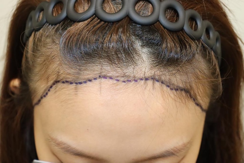 이지용 원장님이 그려주신 라인