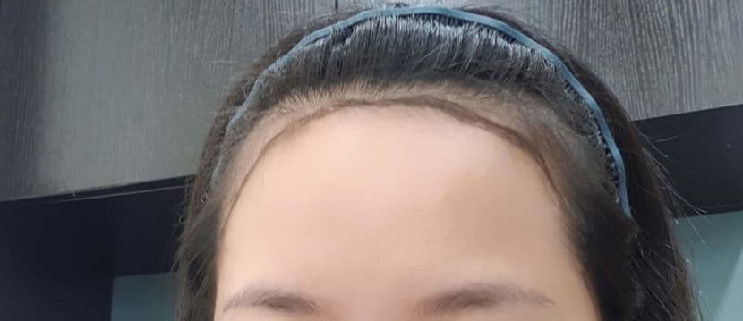 헤어라인 디자인