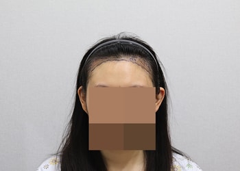 ﻿수술전 디자인