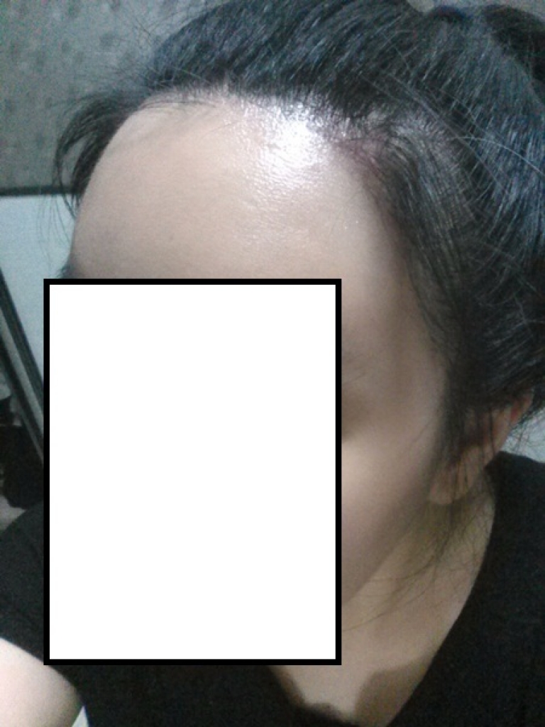 CAM00995.jpg