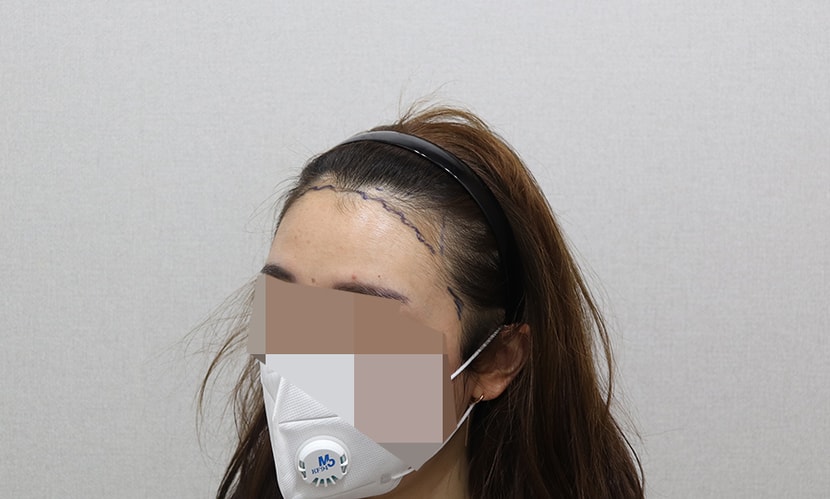 ﻿수술 들어가기 전에 찍은 사진이에요