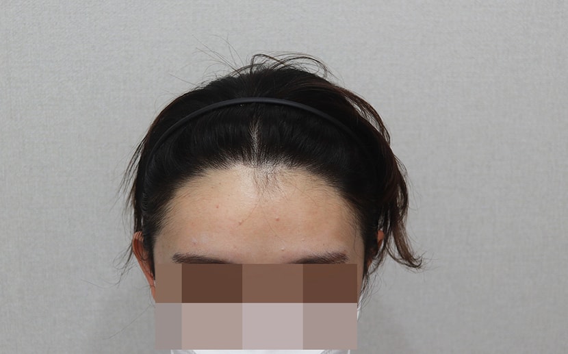 ﻿1년3개월 경과-고개숙이고