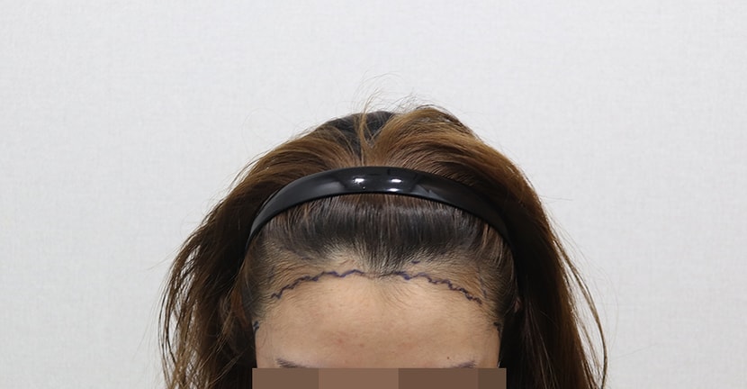 ﻿라인 내릴까 하다가 안내리고 엠자채우고 대칭만 맞췄어요