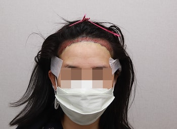 ﻿수술끝나고