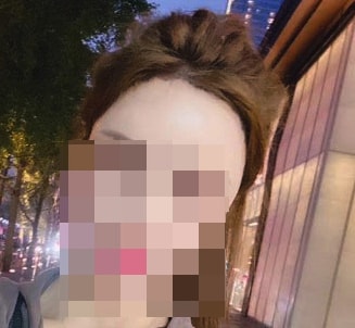 일요일에 저녁에 산책하면서 찍은 셀카 '-' 자세히 보면 이식부위가 보여요 저정도 가린 게 최선입니당  아직도 싸인펜 라인이 안없어졌어요.......ㅎ