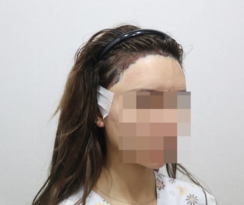 수술하고 찍은 사진