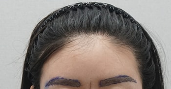 2년8개월째 눈썹 리터치  1차 디자인 후 