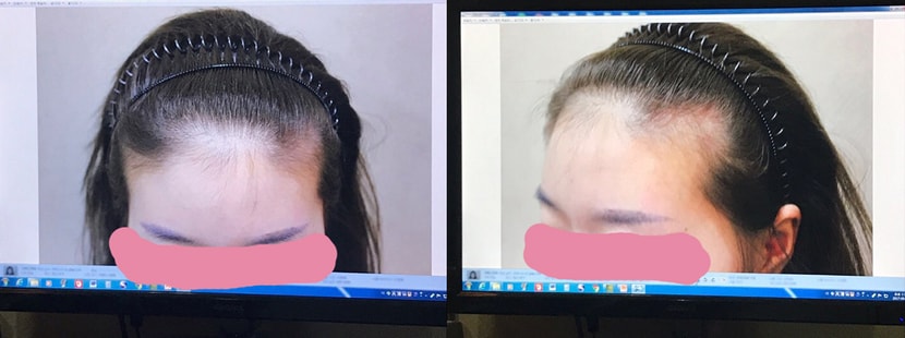 수술전 사진이에요 