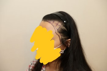수술 전 디자인