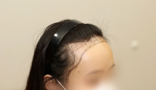 상담 당일 오른쪽