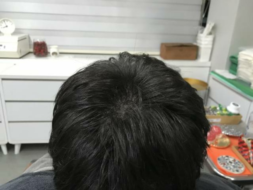 1차 (후)