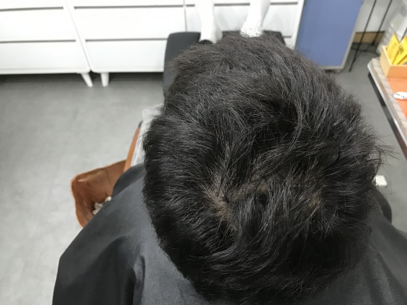 2차 (전)