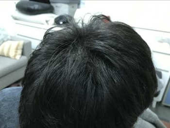 1차 (후)