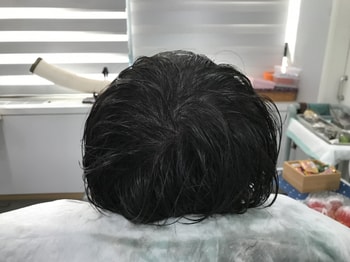 2023년도 3월 두피 리터치 후 젖은모발