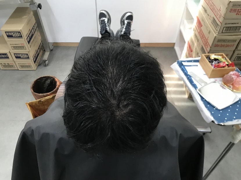 리터치 전 