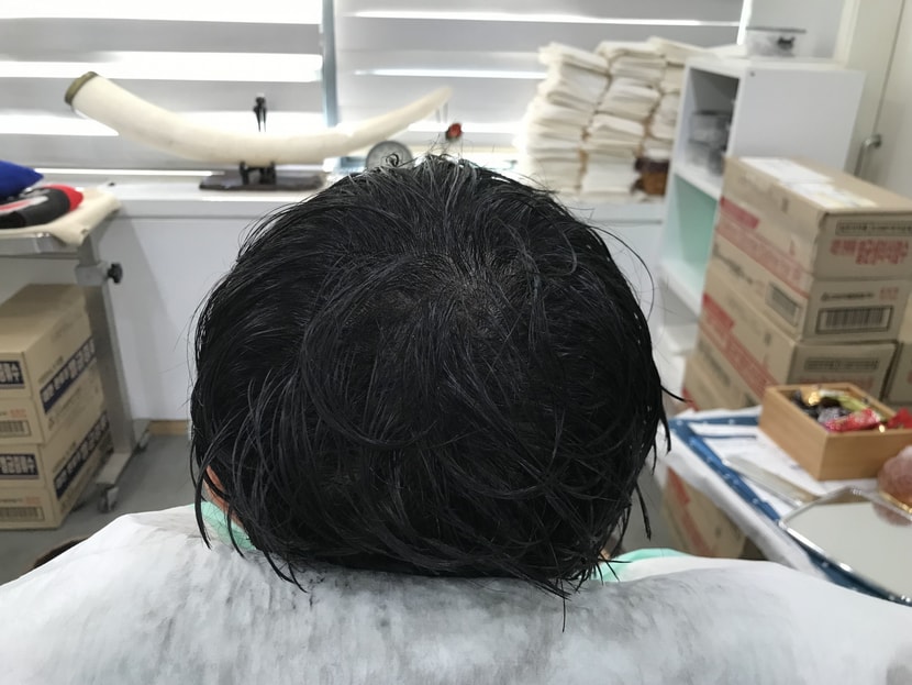 리터치 후